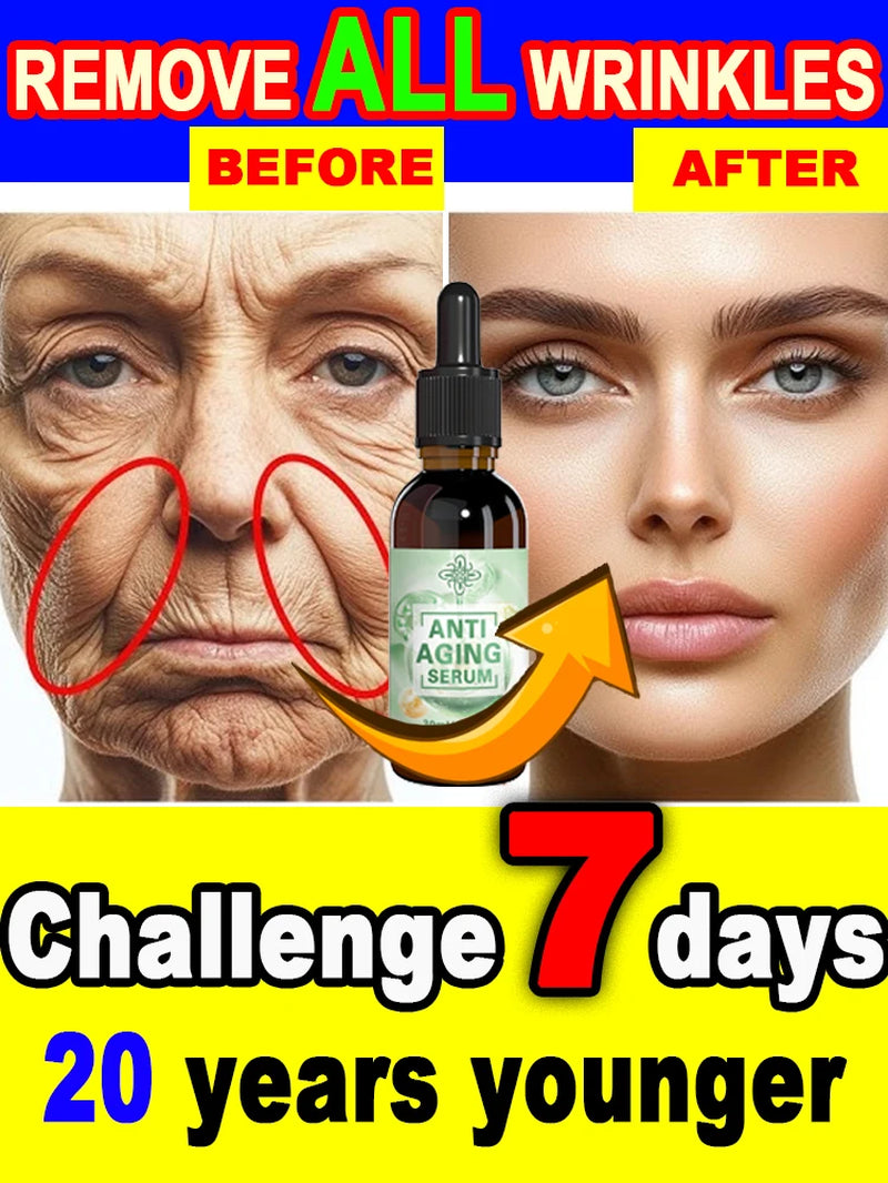 Wrinkles Disappeared