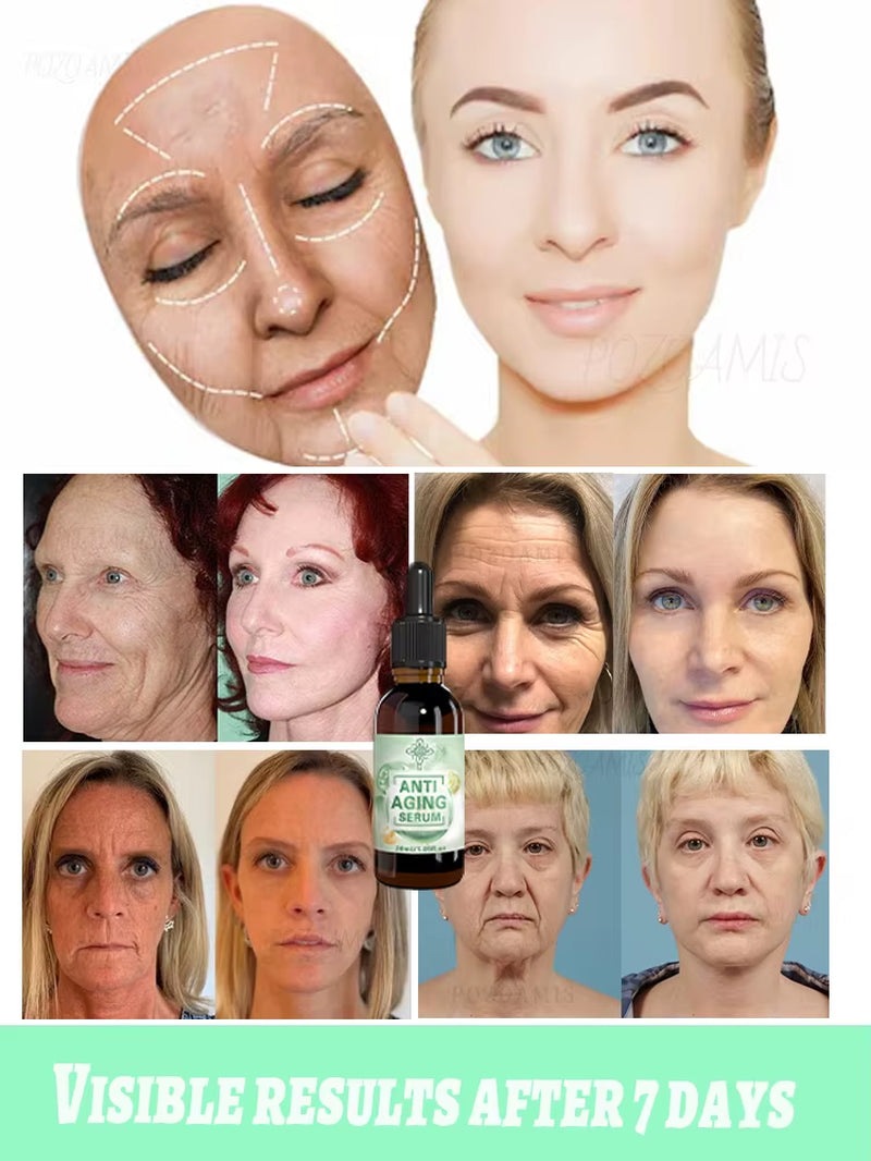 Wrinkles Disappeared